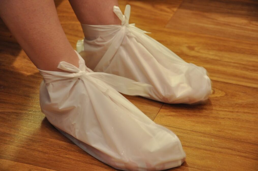 κομπρέσες για αρθρώσεις αστραγάλου