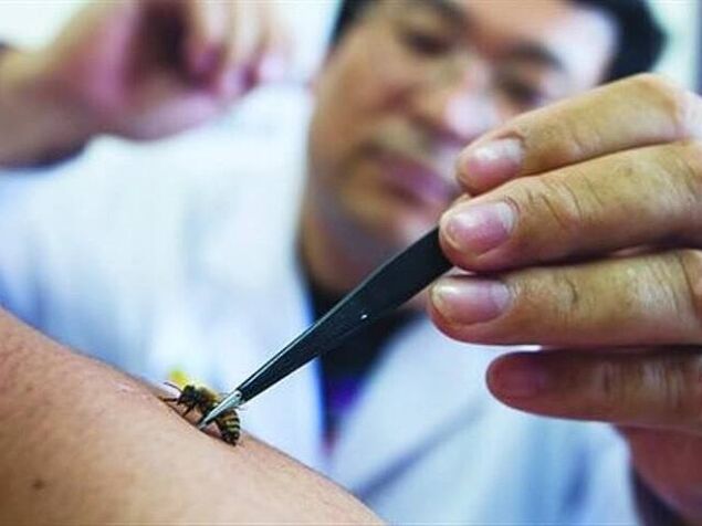 μελισσοθεραπεία για αυχενική οστεοχονδρωσία